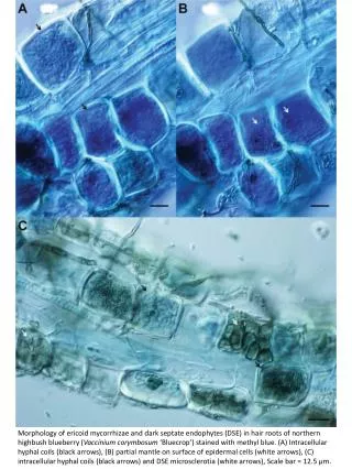 949855ERM and DSE in blueberry roots