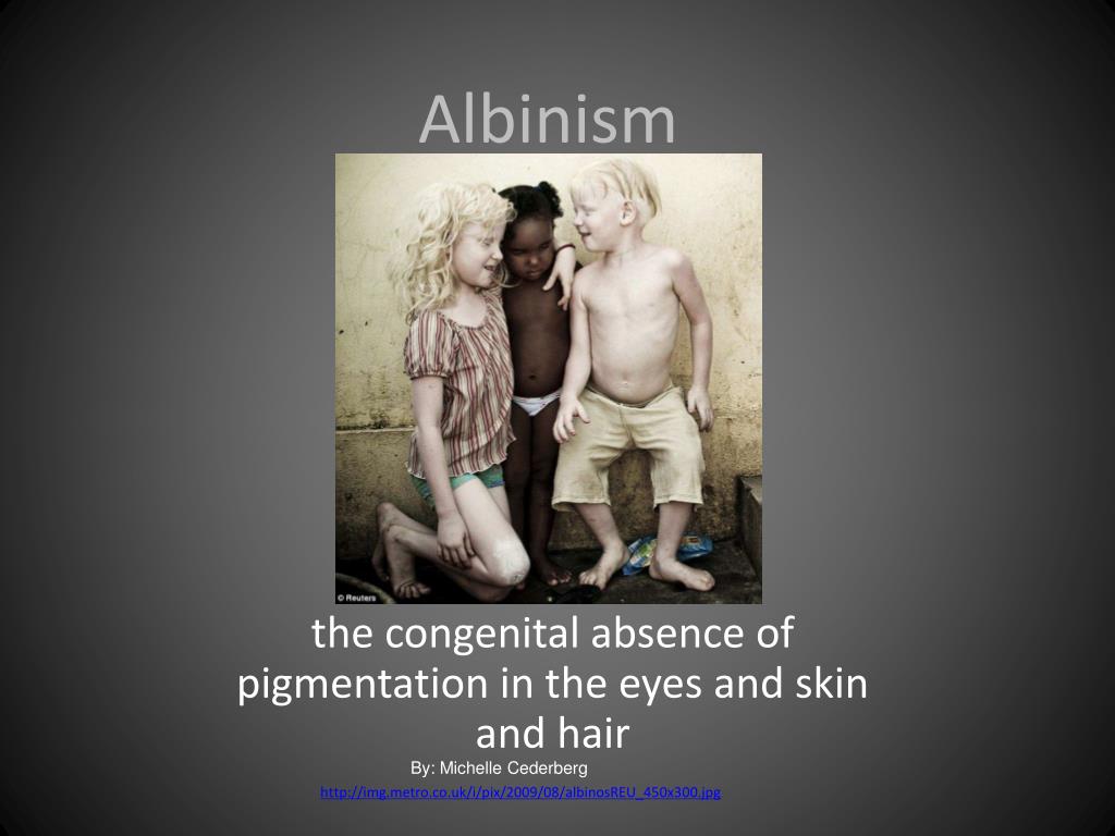 PPT - Albinism PowerPoint Presentation, free download - ID:2109092
