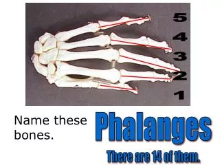 Name these bones.