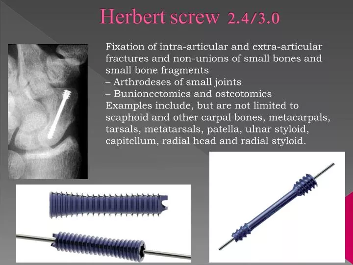 herbert screw 2 4 3 0