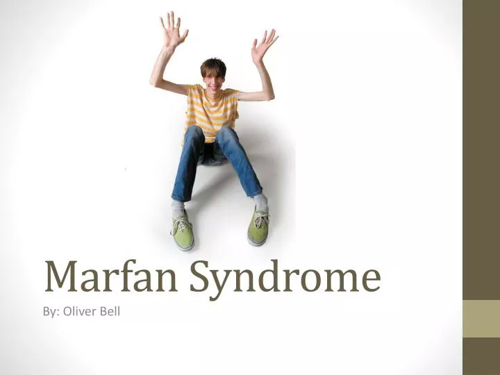 PPT - Marfan Syndrome PowerPoint Presentation, free download - ID:2111775