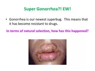 Super Gonorrhea?! EW!