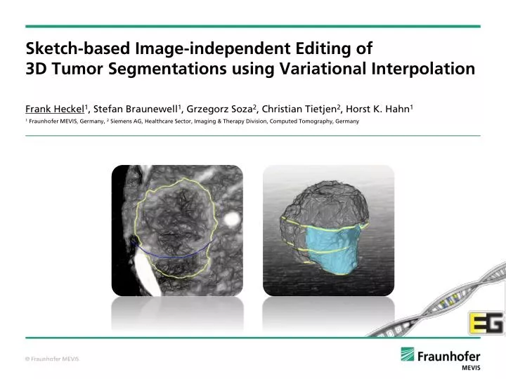 sketch based image independent editing of 3d tumor segmentations using variational interpolation