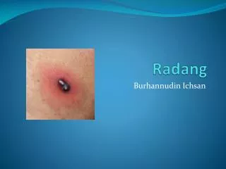 radang