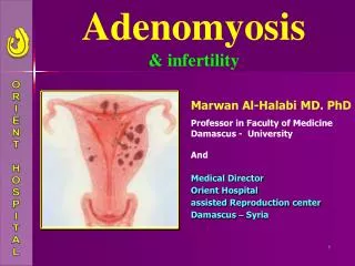 Adenomyosis &amp; infertility