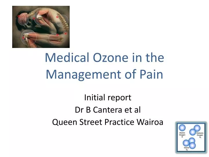 medical ozone in the management of pain