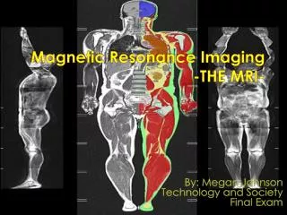 Magnetic R esonance Imaging -THE MRI-
