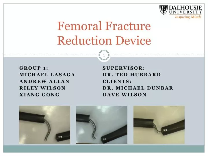 femoral fracture reduction device