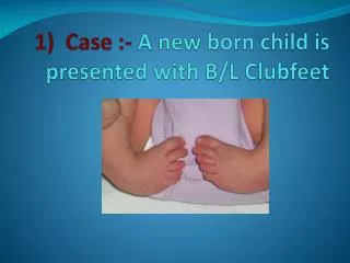 1) Case :- A new born child is presented with B/L Clubfeet