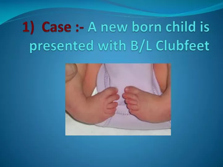 1 case a new born child is presented with b l clubfeet