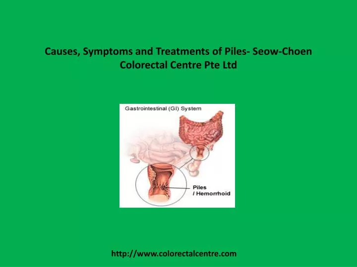 causes symptoms and treatments of piles seow choen colorectal centre pte ltd