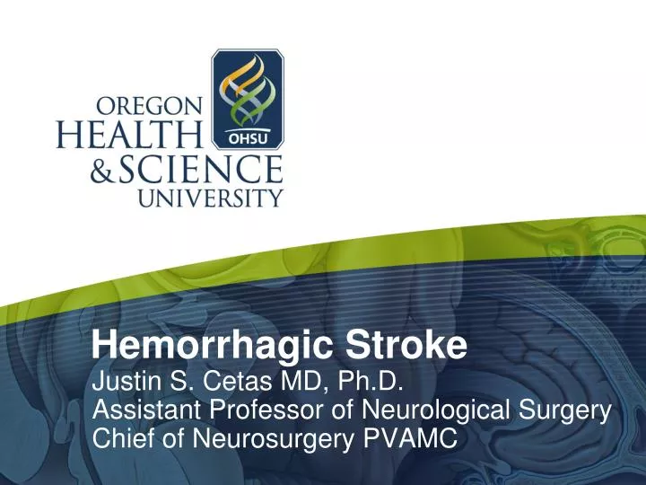 hemorrhagic stroke