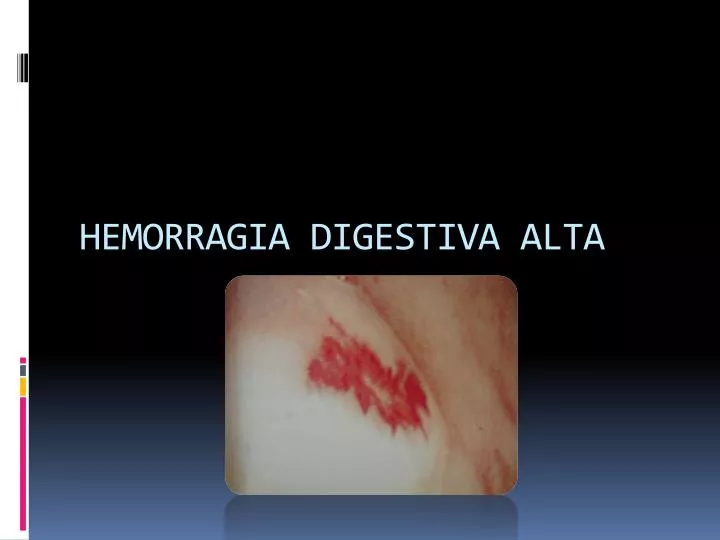 hemorragia digestiva alta