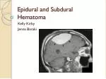 Epidural and Subdural Hematoma