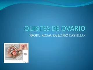 quistes de ovario