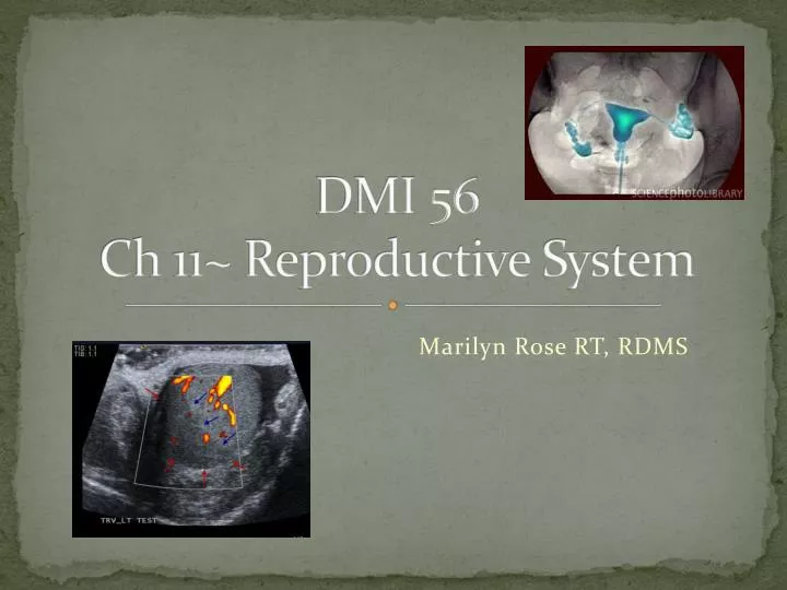 dmi 56 ch 11 reproductive system