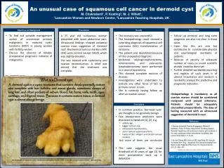 An unusual case of squamous cell cancer in dermoid cyst