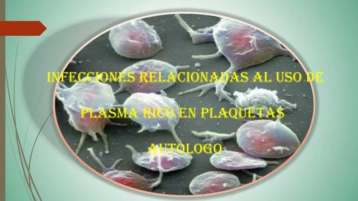 infecciones relacionadas al uso de plasma rico en plaquetas autologo