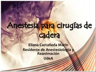 Eliana Castañeda Marín Residente de Anestesiología y Reanimación UdeA