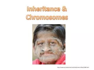 Inheritance &amp; Chromosomes