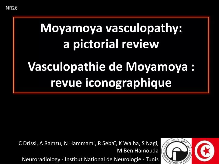 moyamoya vasculopathy a pictorial review vasculopathie de moyamoya revue iconographique