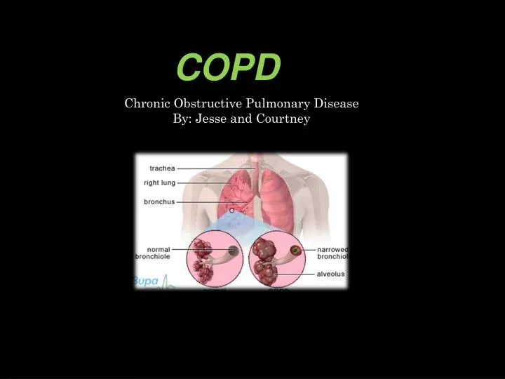 PPT - COPD PowerPoint Presentation, free download - ID:2130414