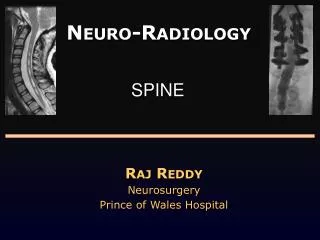 Neuro -Radiology