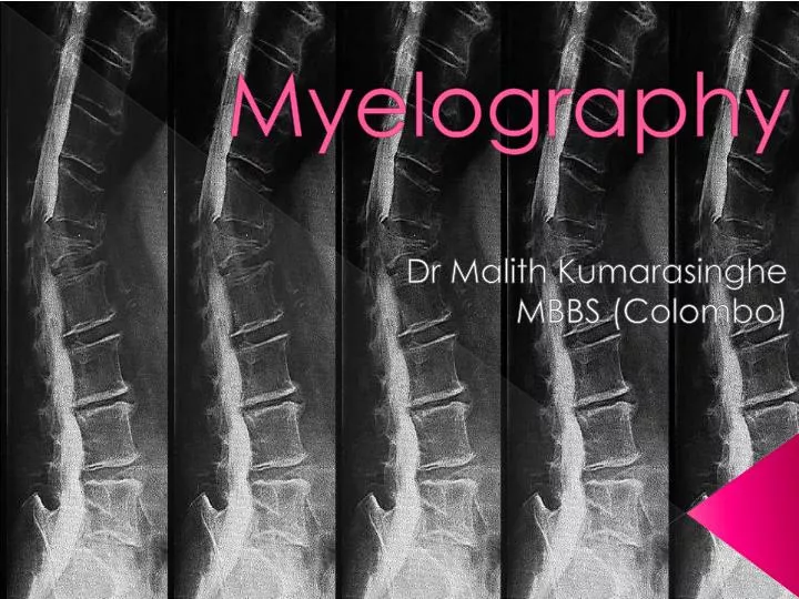 myelography