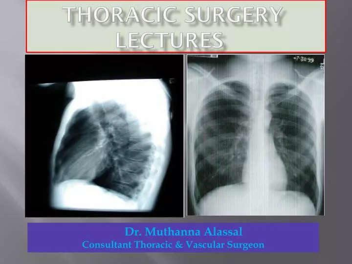 thoracic surgery lectures