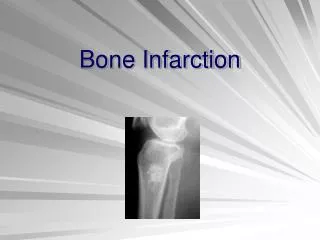 Bone Infarction