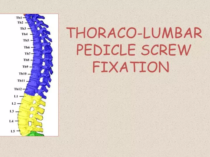 thoraco lumbar pedicle screw fixation
