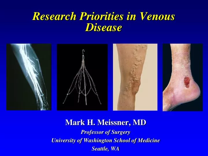 research priorities in venous disease