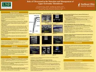 Role of Ultrasound in the Detection and Management of Upper Extremity Thrombosis