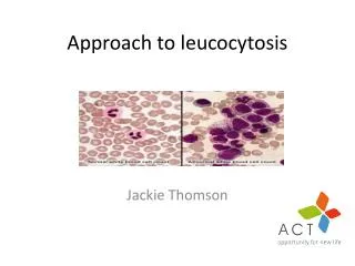 Approach to leucocytosis