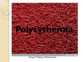 Polycythemia