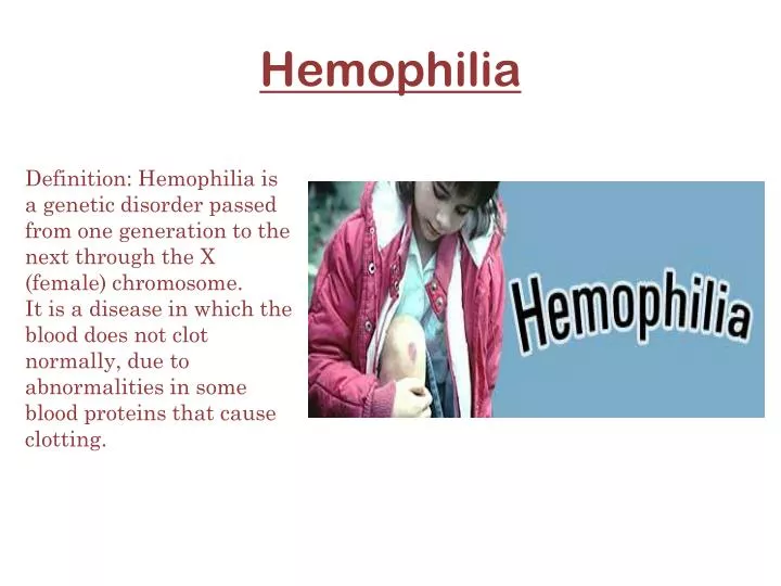 hemophilia