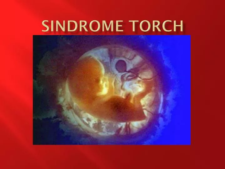 sindrome torch