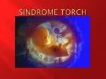 SINDROME TORCH - slide 1
