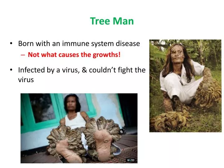 tree man