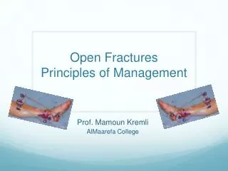 Open Fractures Principles of Management