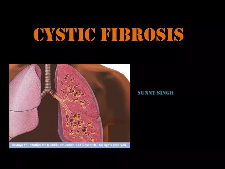 c ystic f ibrosis