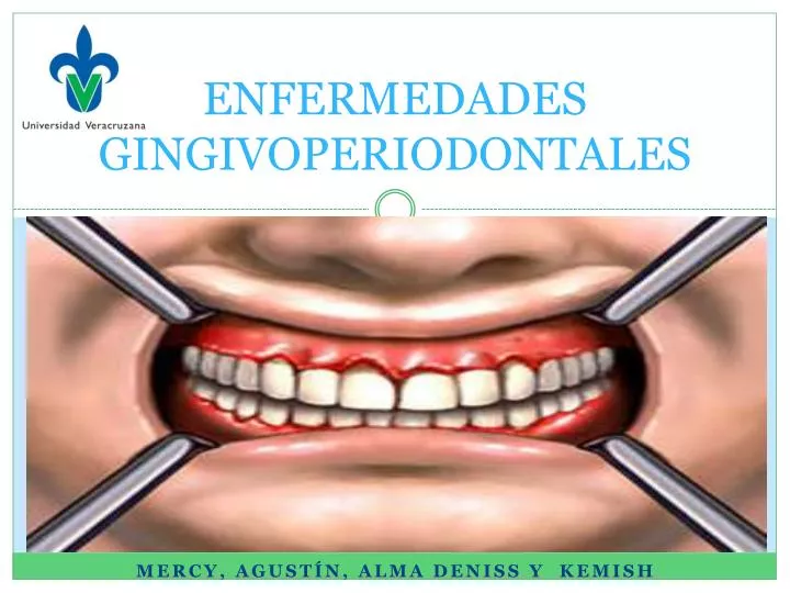 enfermedades gingivoperiodontales