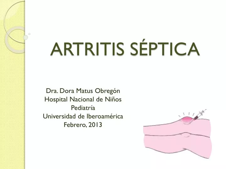 artritis s ptica