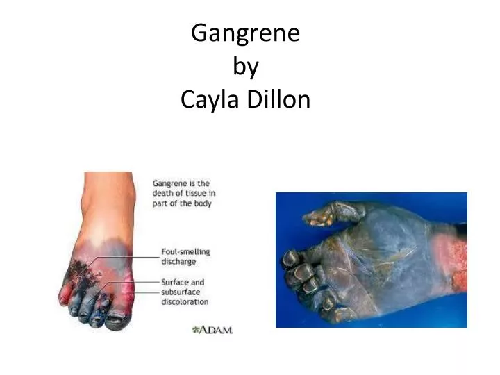 gangrene by cayla dillon