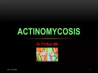 ACTINOMYCOSIS