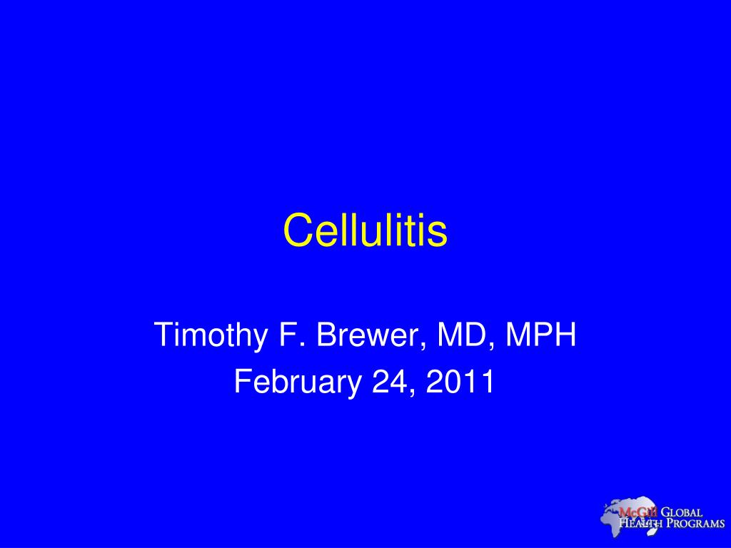 PPT - Cellulitis PowerPoint Presentation, free download - ID:2153406