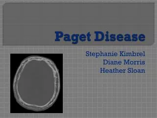 Paget Disease