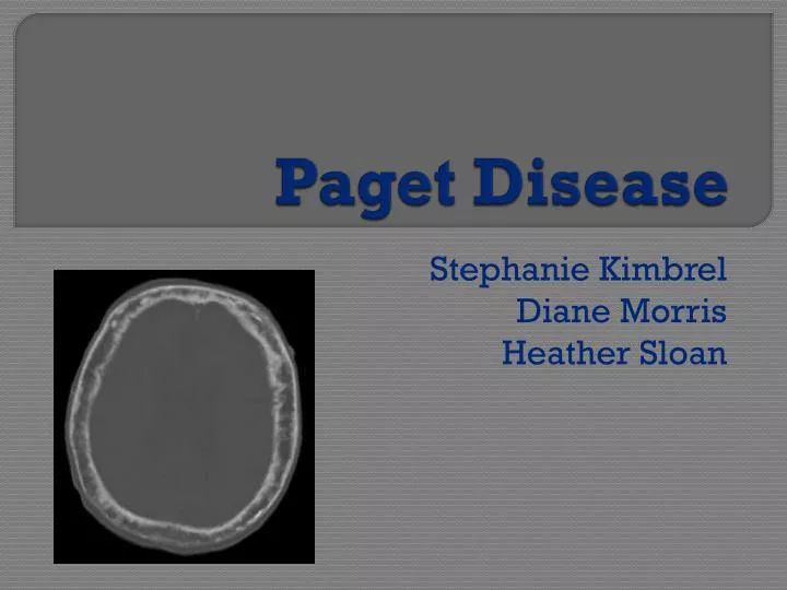 paget disease
