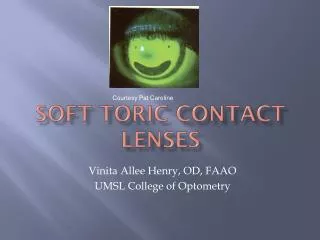 Soft Toric Contact Lenses