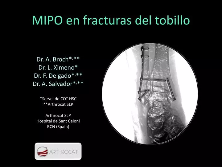 mipo en fracturas del tobillo